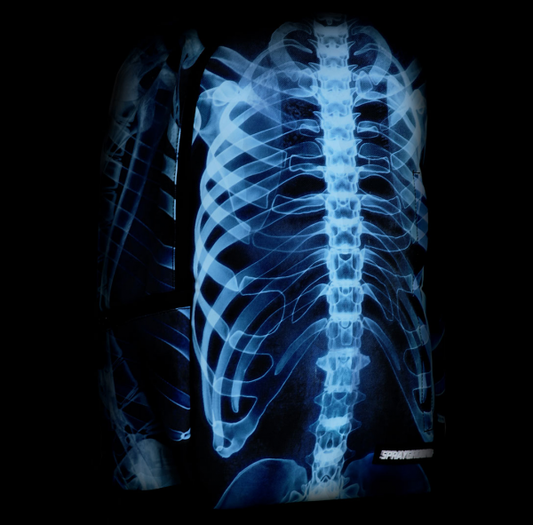 rayos-x-mochila